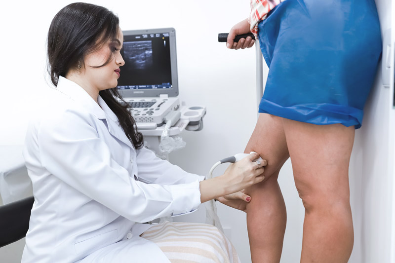 Consulta com ultrassom vascular